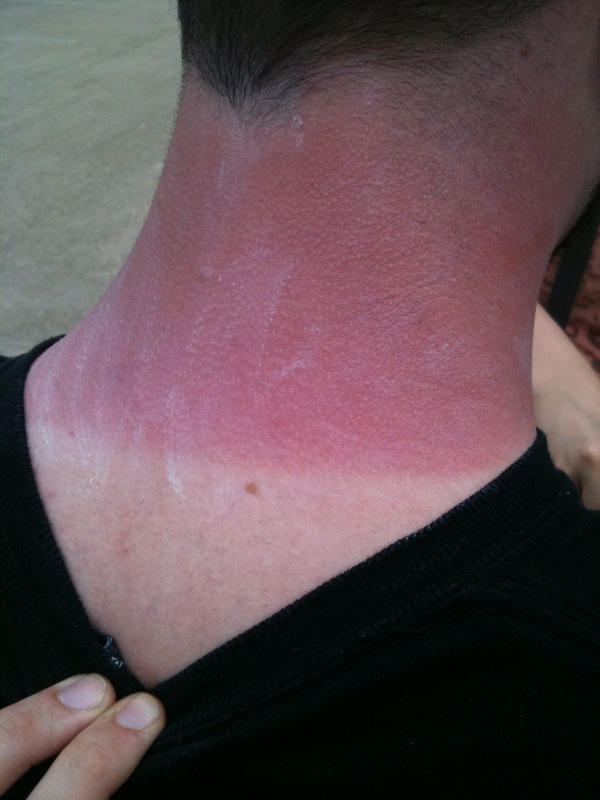 photo2